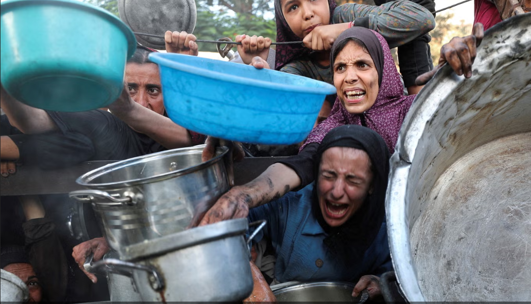 أطفال غزة يعانون من سوء التغذية الحاد