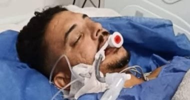 التحقيق في حادثة توقف قلب شاب أثناء إجراء عملية جراحية في بورسعيد
