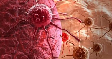 الصحة تكشف التوقيت الأمثل لعلاج السرطان خلال 6 أسابيع بين الحياة والموت