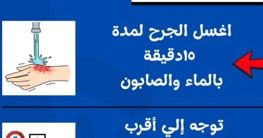 صحة كفر الشيخ: 12 مستشفى تعمل على مدار 24 ساعة لعلاج مصابى عقر الحيوانات