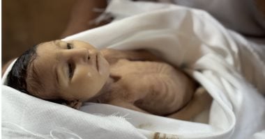 غدير الرضيعة ضحية التجويع الإسرائيلي في غزة تموت نتيجة سوء التغذية بعمر 5 أشهر