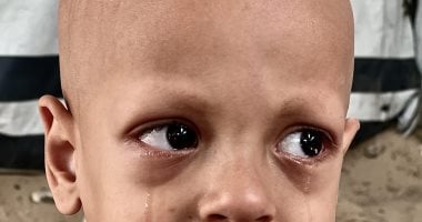 وفاة الطفل الفلسطيني صاحب جملة "أنا جعان".. قصة مأساوية توثقها الصور
