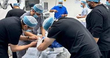 زراعة القوقعة بأسعار مخفضة ضمن التأمين الصحي الشامل مقابل 482 جنيهاً بدلاً من مليون جنيه